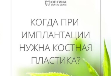 Когда при имплантации нужна костная пластика?